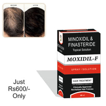Load image into Gallery viewer, MOXIDIL-F Topical Solution for HAIR FALL CONTROL
